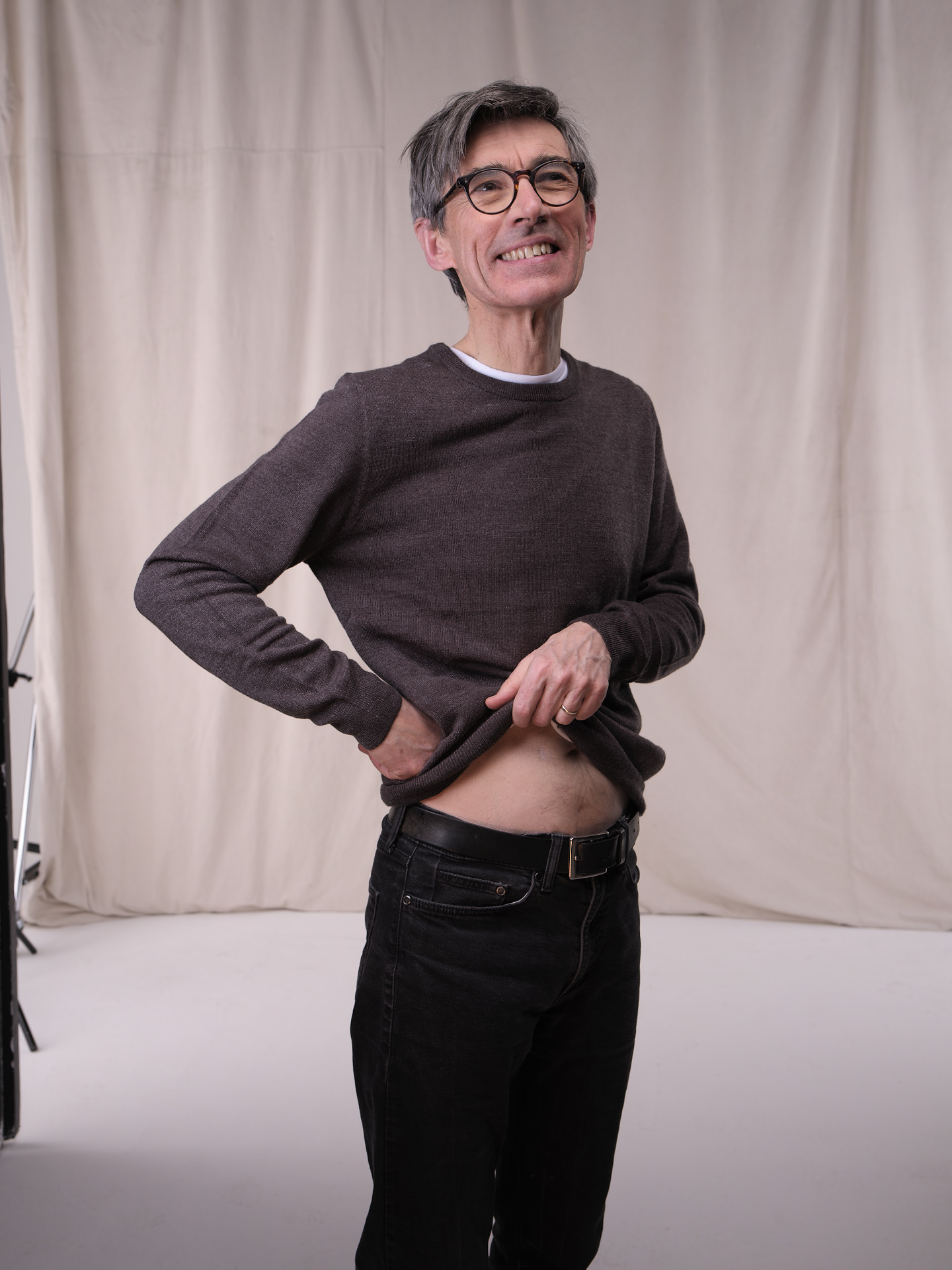 Living kidney donor John lifting his top