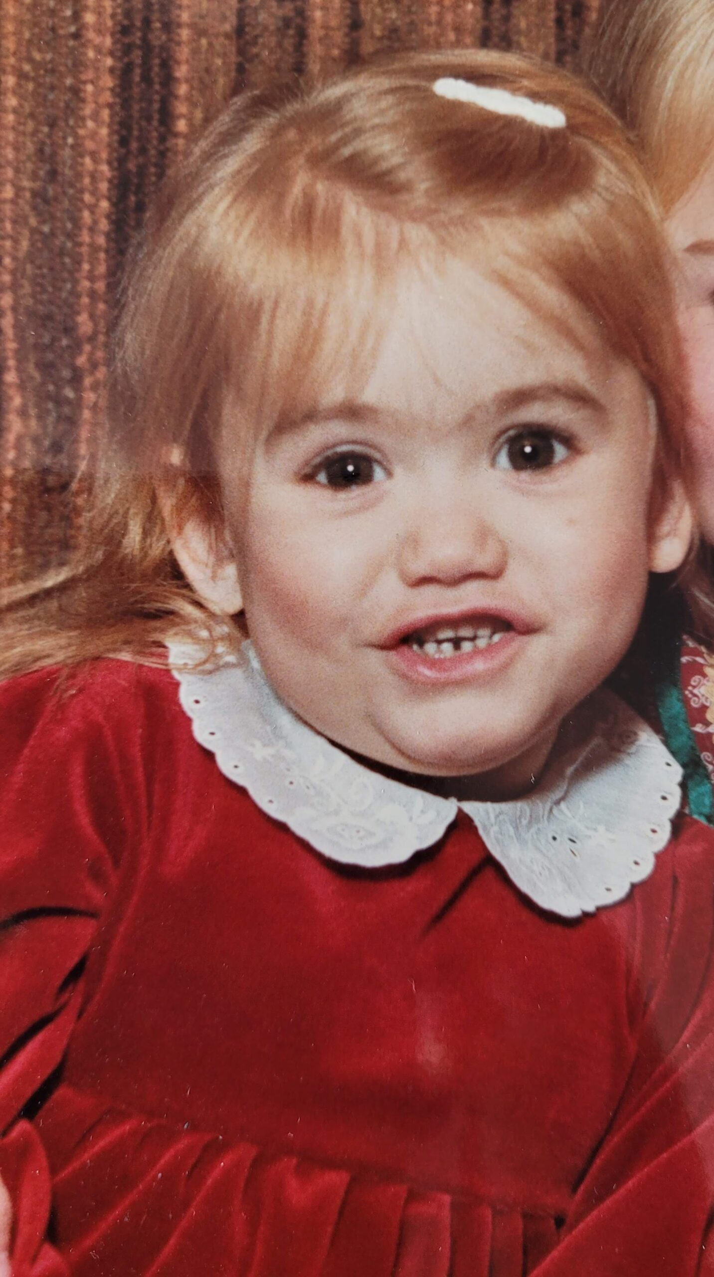 Living kidney recipient Cheryl as a child