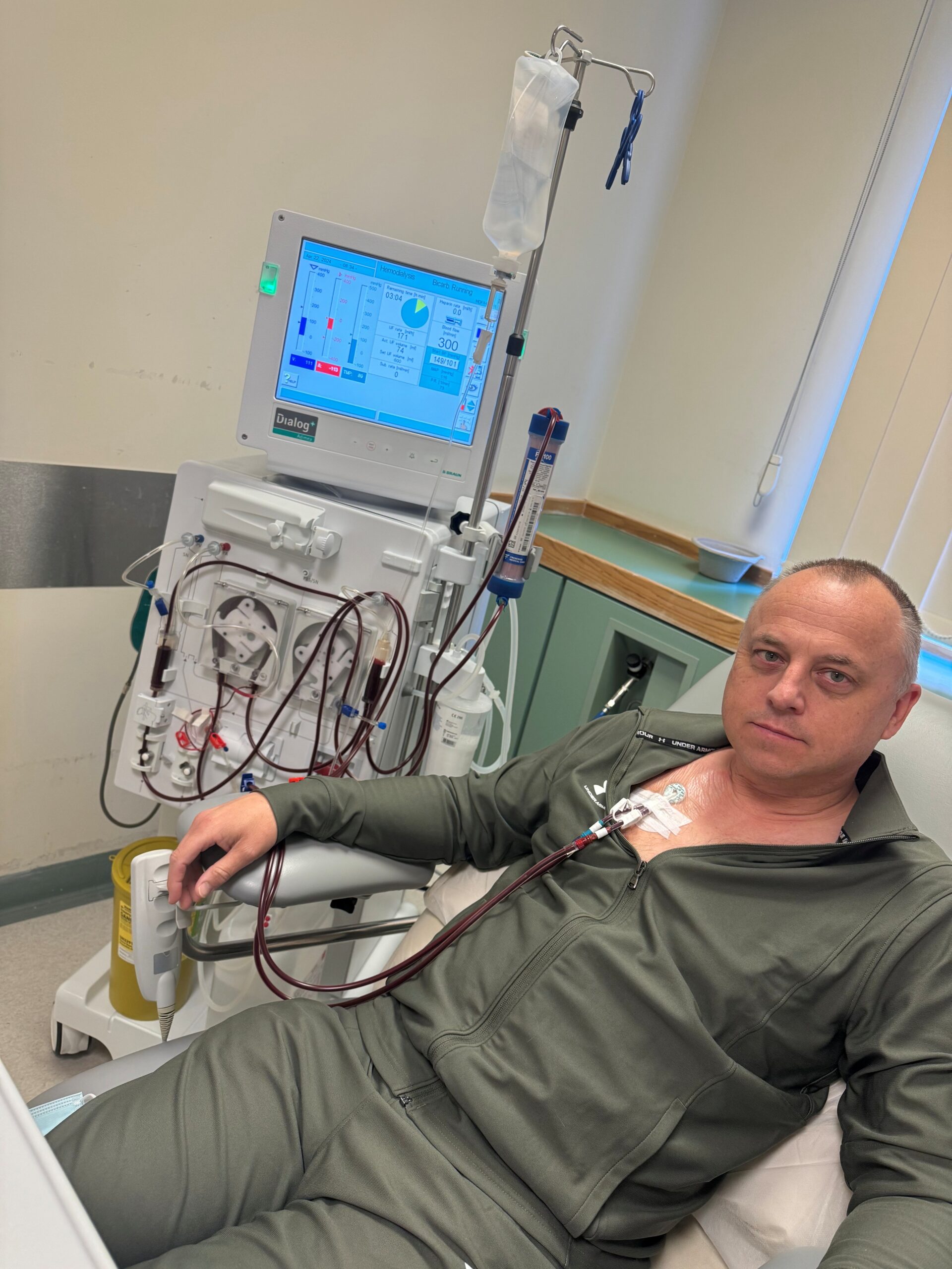 Image of living kidney recipient Andy in a sage coloured dressing gown in a hospital, attached to a dialysis machine. He is looking at the camera solemnly.