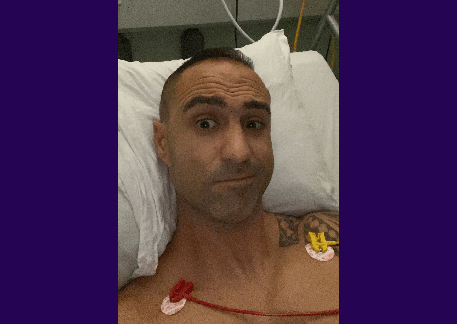Living kidney donor Adam laying in a hospital bed taking a selfie. He is topless and has two monitors attached to his chest. He is looking at the camera and giving a half-smile.